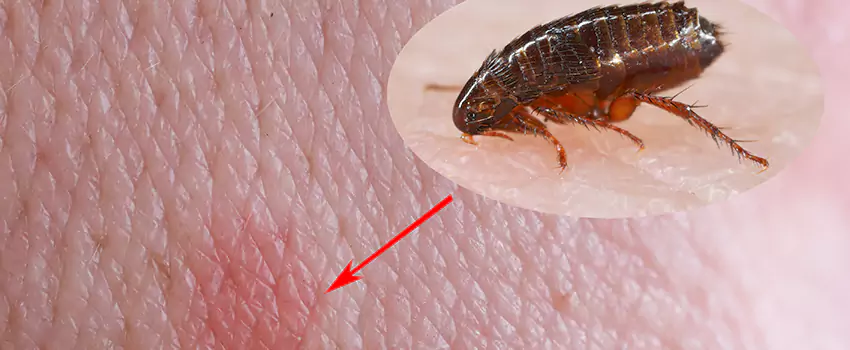 Flea Control for Humans Oceanside, CA